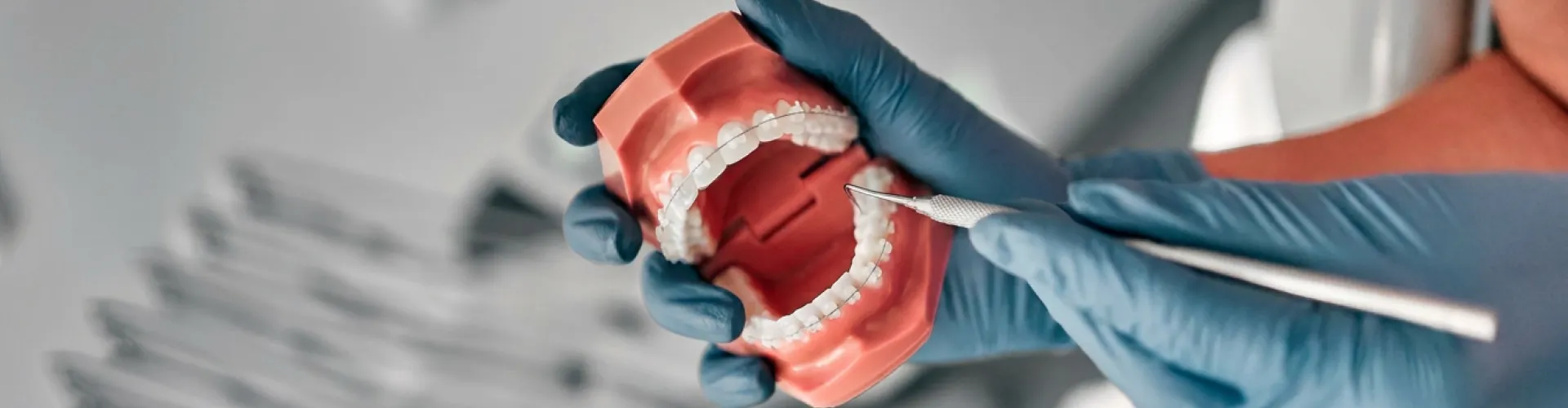 Ceramic dental braces on a dental model being examined with a dental instrument.