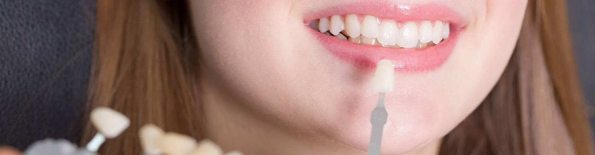 A woman smiling with a sample veneer held in front of her teeth to check the ideal color.