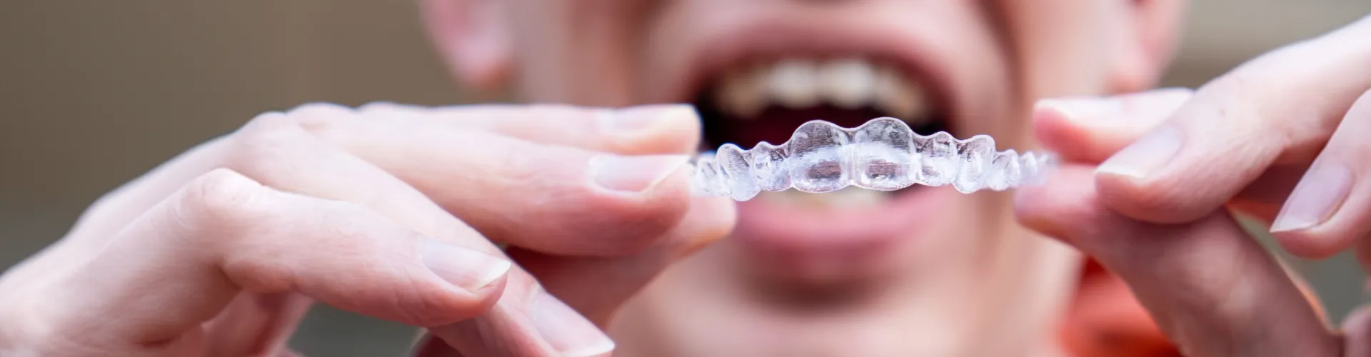 Close-up of a woman smiling while holding a clear orthodontic aligner near her teeth.