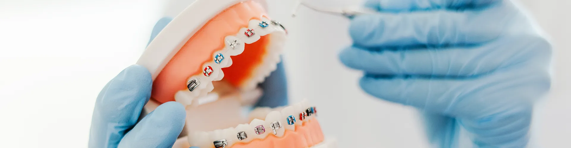 Mouth model with dental braces.