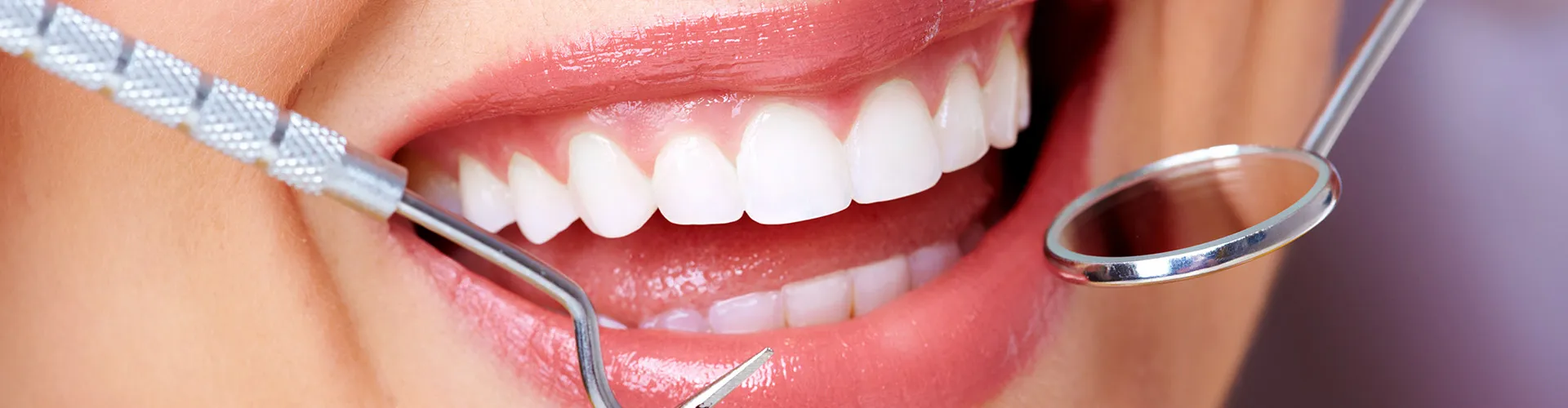 Close-up of a smile surrounded by dental tools.