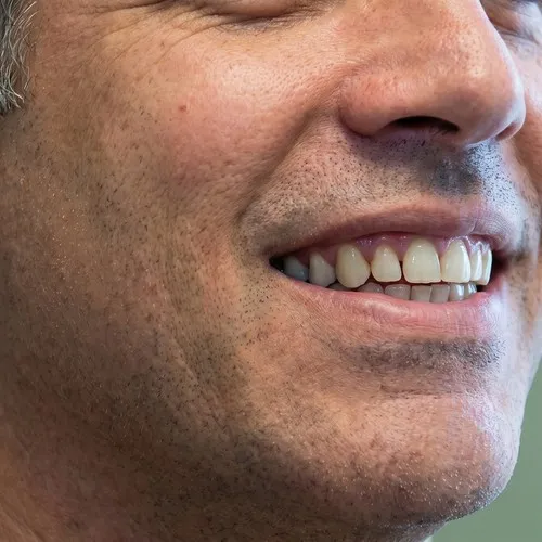 Close photo of man's smile.