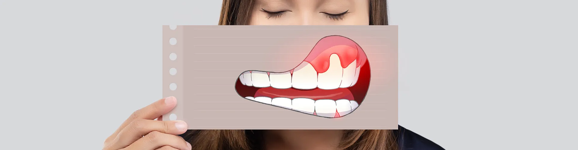 Woman holding a drawing of inflamed gums in front of her mouth.