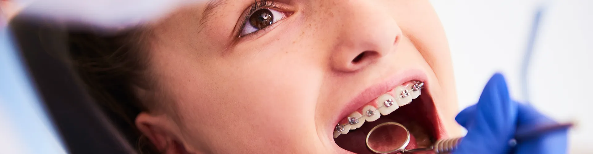 Gloved hand using dental tool on smile of girl with braces.