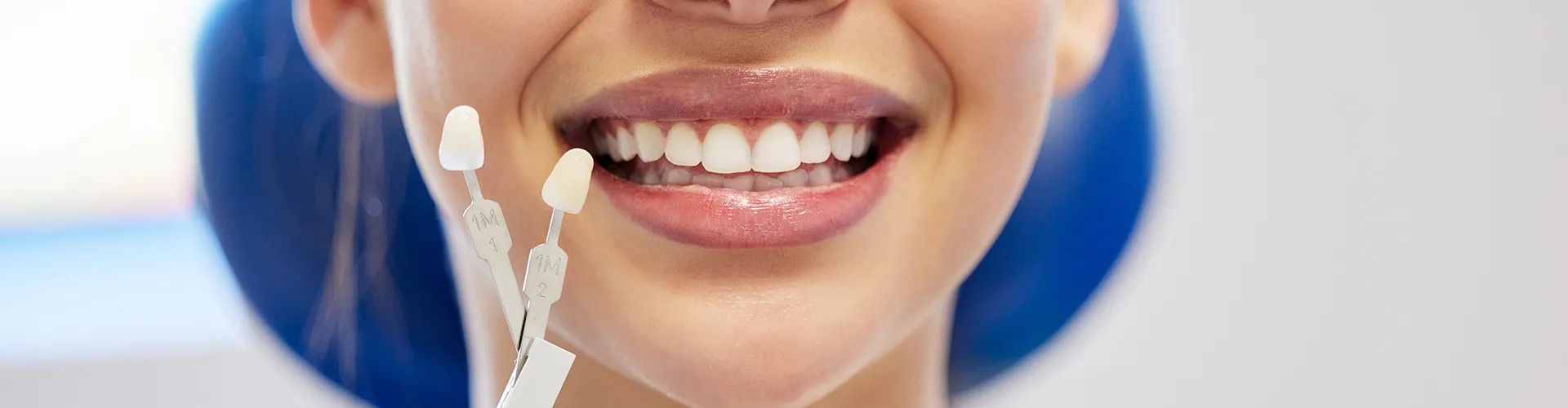 Gloved hand holding tooth shade-matching tool by woman's smile.