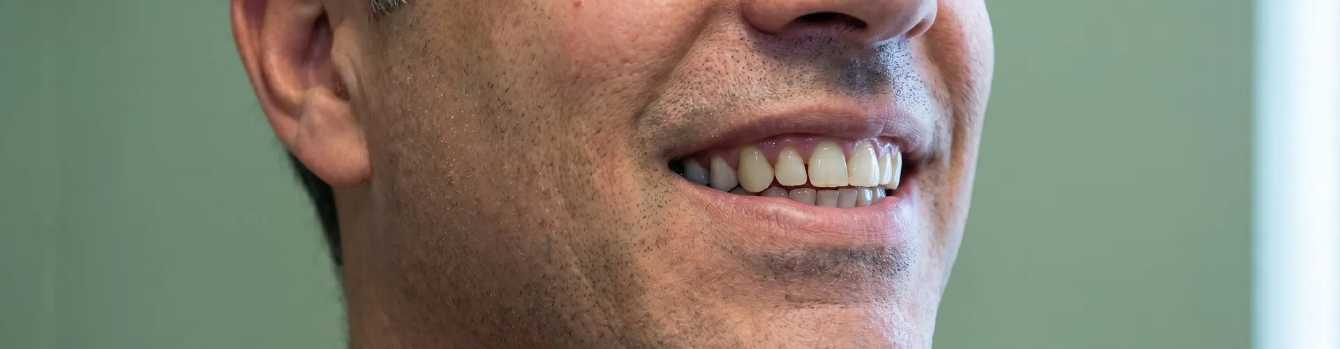 Close photo of man's smile.