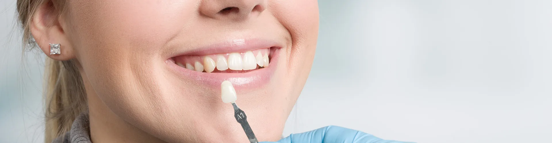 Woman with tooth shade-matching tool held next to her smile.