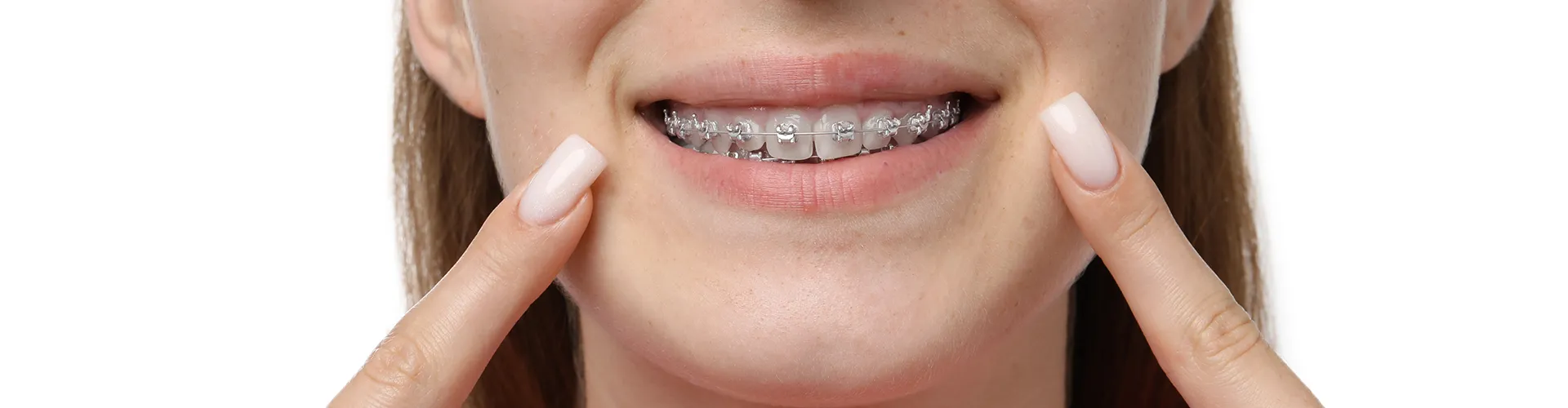 Smiling female pointing at braces.