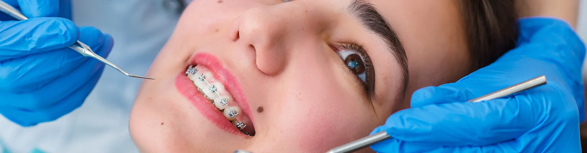Gloved hand holding dental mirror beside smiling girl with braces.