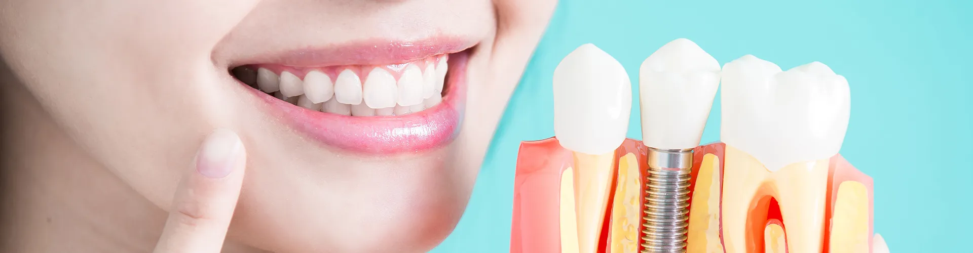 A woman smiling while holding a tooth model that shows a dental implant.