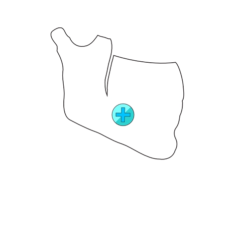 Denture illustration