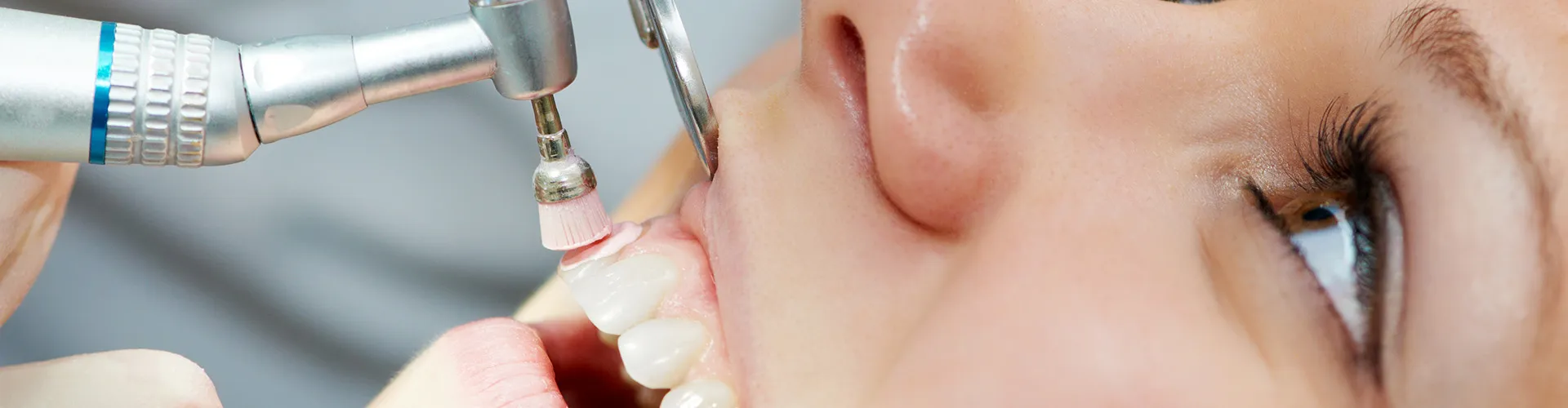 Woman having her teeth cleaned.