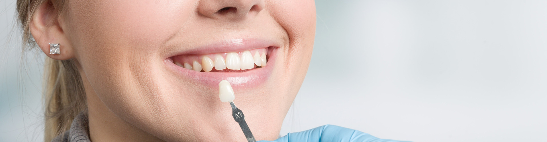 Woman with tooth shade-matching tool held next to her smile.
